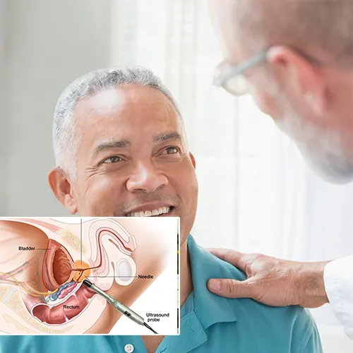 Choose  Surgery Center of Fremont 
for Comprehensive Penile Implant Support