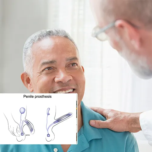 Penile Implants  A Game Changer In Intimacy